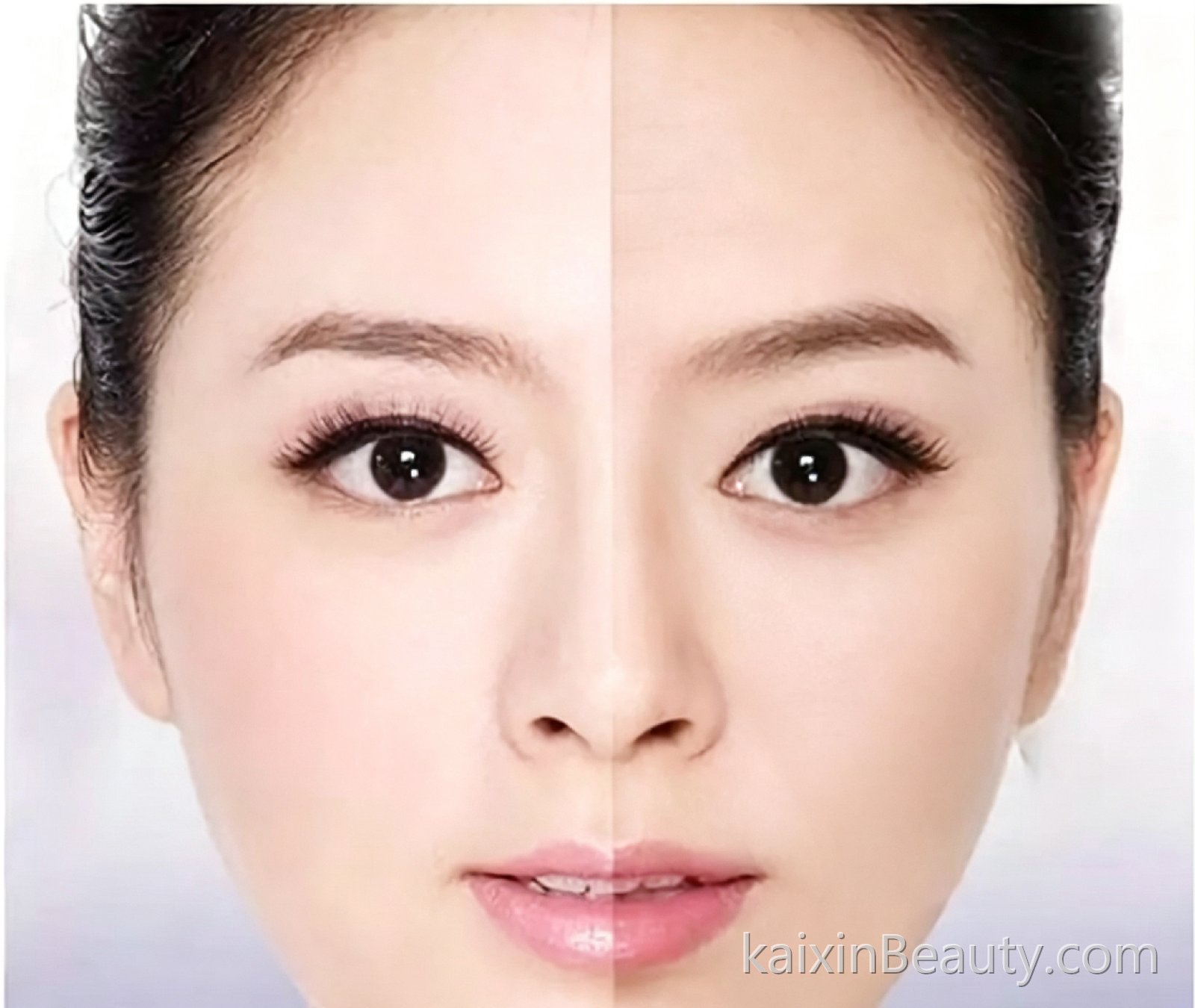 《美白全通路（下）：还原淡化 + 加速代谢》——已经形成的黑色素怎么“消灭”？果酸、VC在这一路怎么发挥作用？