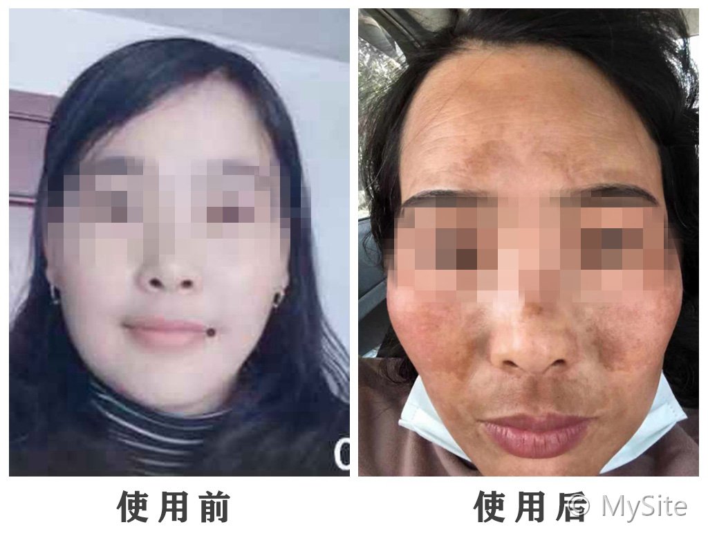 "三天美白七天淡斑"——听到这八个字，请立刻拉黑