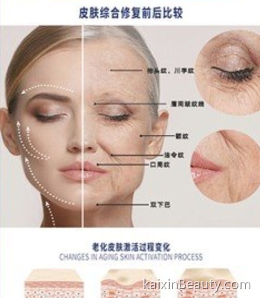 《80%的皮肤问题，都是“折腾”出来的》——过度清洁、过度护肤、频繁医美……为什么“太努力”反而让皮肤更差？